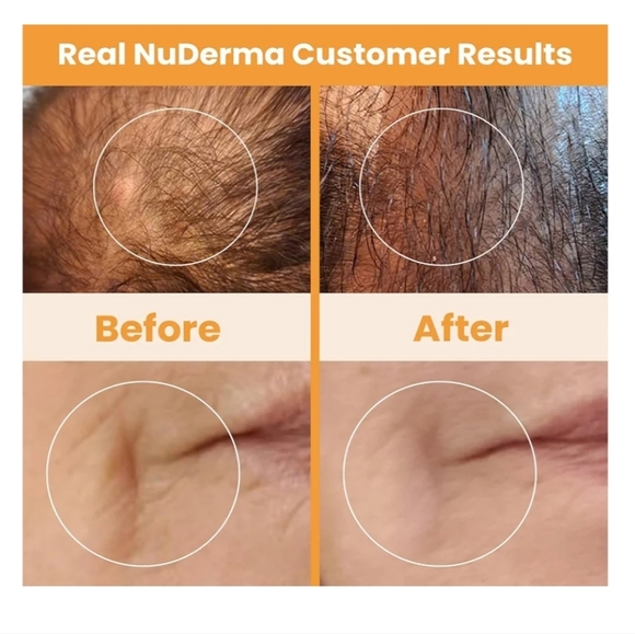 NuDerma Cell Energy Amplification System New In Box - Picture 7 of 11